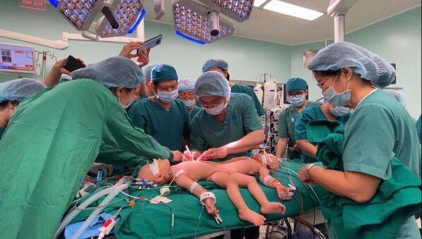 Các bác sĩ giỏi của Việt Nam tham gia ê-kip mổ chuẩn bị tách rời hai bệnh nhi song sinh dính nhau. Các vùng phẫu thuật được xác định và đánh dấu kỹ càng, cẩn thận. - Sputnik Việt Nam