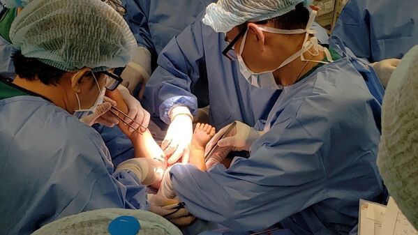 Các bác sĩ sau khi phẫu thuật tách rời Trúc Nhi và Diệu Nhi, tiến hành giai đoạn chỉnh hình xương khung chậu, kéo vạt da che các cơ quan - Sputnik Việt Nam