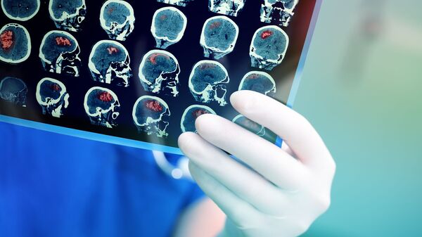 Chụp MRI não của bệnh nhân - Sputnik Việt Nam