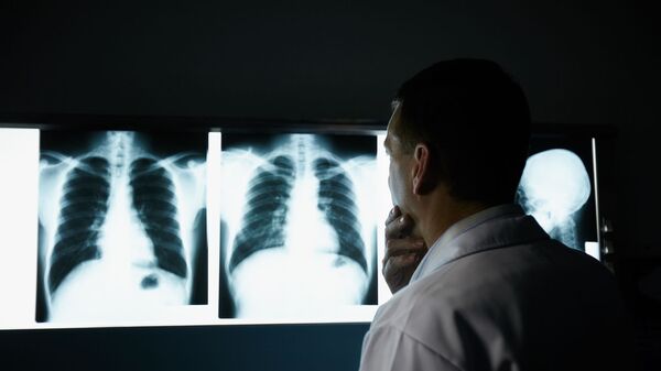 Bác sĩ kiểm tra phim chụp X-quang phổi - Sputnik Việt Nam
