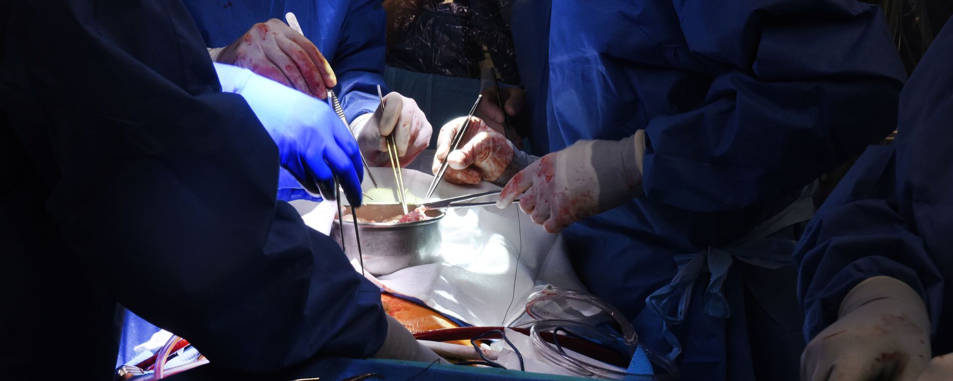 Ca phẫu thuật ghép tim lợn cho người của các bác sĩ phẫu thuật tại Trung tâm Y tế Đại học Maryland - Sputnik Việt Nam, 1920, 21.01.2022
