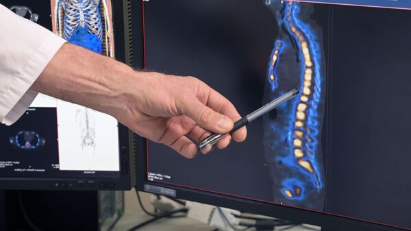 Các phần cột sống của bệnh nhân bị ảnh hưởng do di căn trên màn hình điều khiển trong khoa X quang - Sputnik Việt Nam