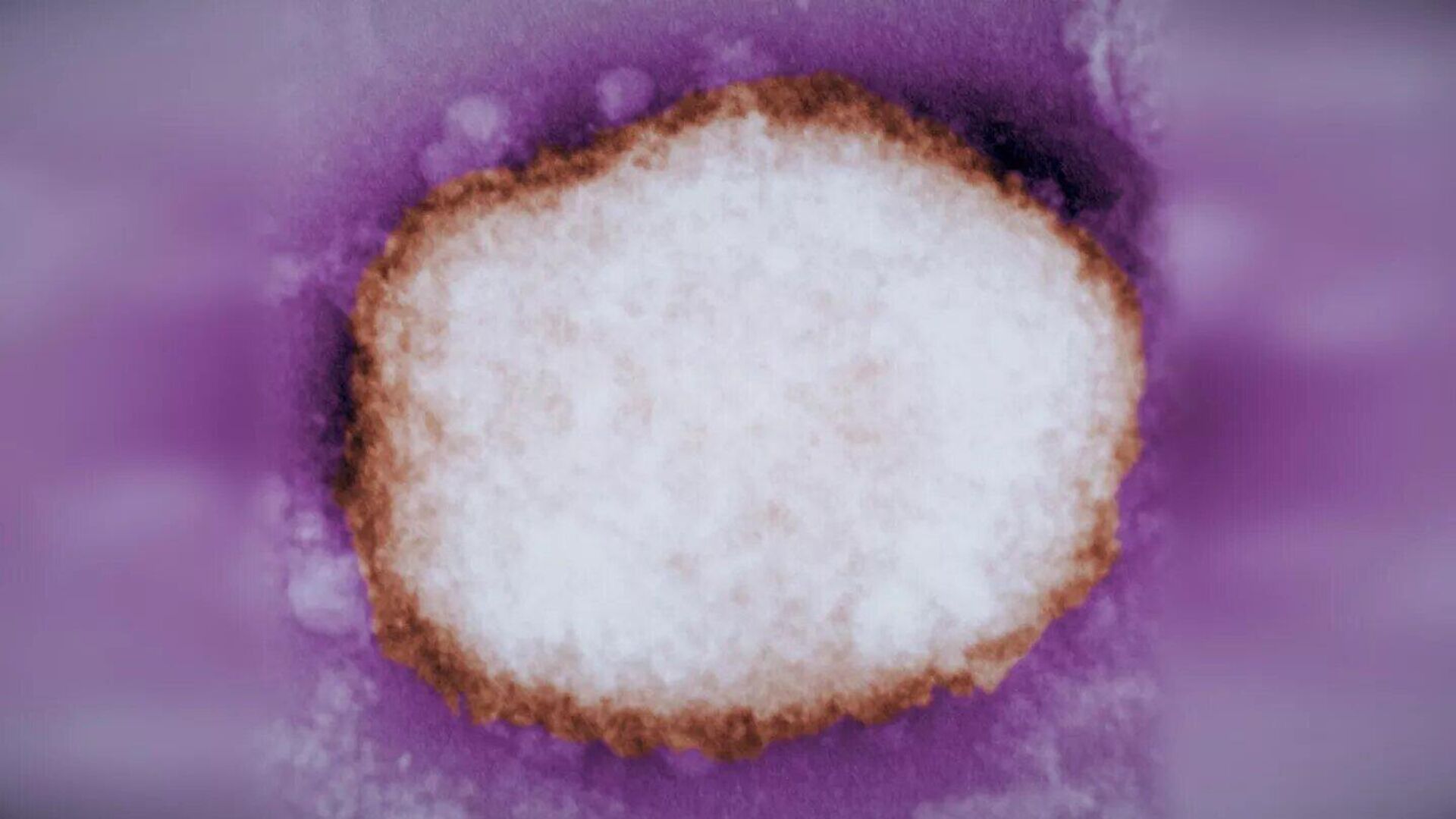 Virus đậu mùa khỉ dưới kính hiển vi điện tử - Sputnik Việt Nam, 1920, 20.05.2022