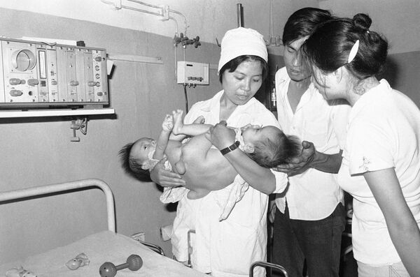 Hai bé song sinh dính liền một tuổi ở Bệnh viện Việt Đức, Hà Nội, một trung tâm điều trị cho trẻ em bị ảnh hưởng bởi chất độc màu da cam do quân đội Mỹ sử dụng trong chiến tranh. - Sputnik Việt Nam