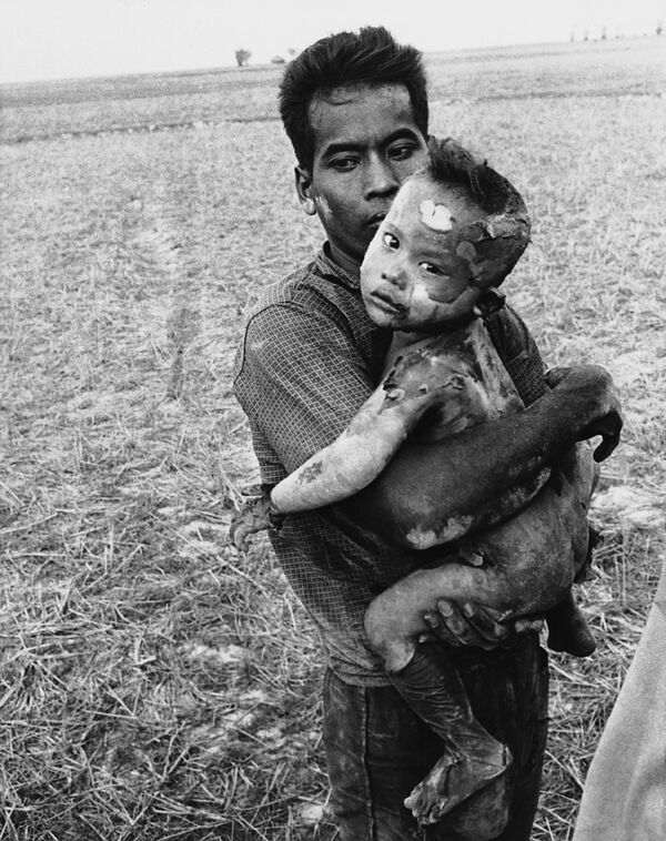 Đứa trẻ với cơ thể đầy vết bỏng do bom napalm được cha ôm sau khi được giải cứu khỏi một ngôi làng Việt Nam gần biên giới Campuchia, ngày 19 tháng 3 năm 1964. - Sputnik Việt Nam
