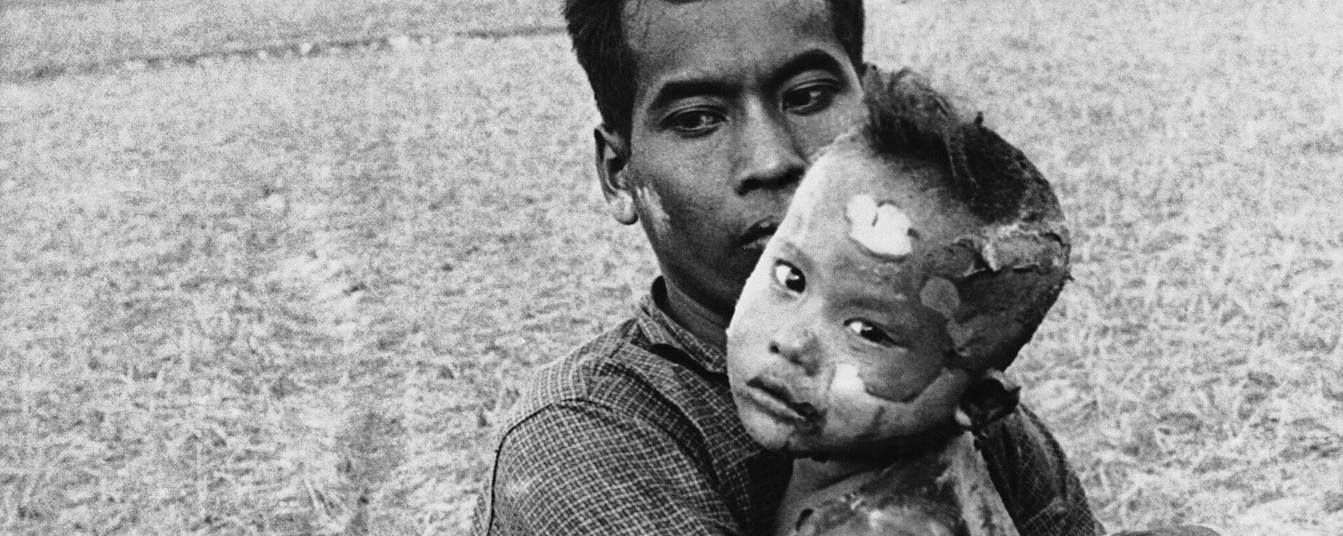 Đứa trẻ với cơ thể đầy vết bỏng do bom napalm được cha ôm sau khi được giải cứu khỏi một ngôi làng Việt Nam gần biên giới Campuchia, ngày 19 tháng 3 năm 1964. - Sputnik Việt Nam, 1920, 11.01.2023