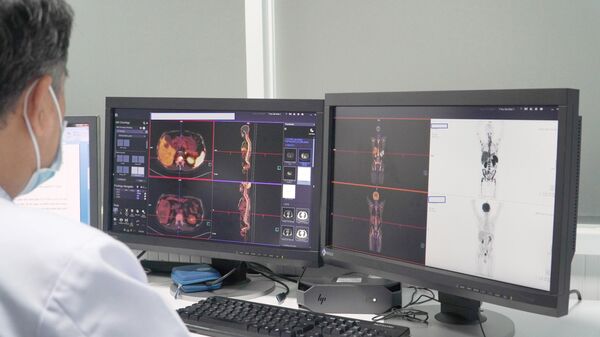 Hình ảnh chụp PET/CT của bệnh nhân tại Bệnh viện Chợ Rẫy Thành phố Hồ Chí Minh. - Sputnik Việt Nam