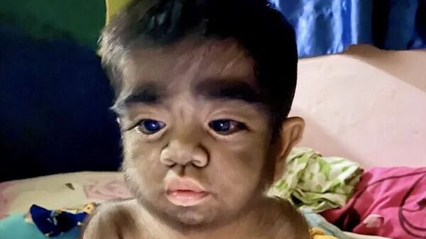 Cậu bé 2 tuổi Jaren Gamogan từ Philippines - Sputnik Việt Nam