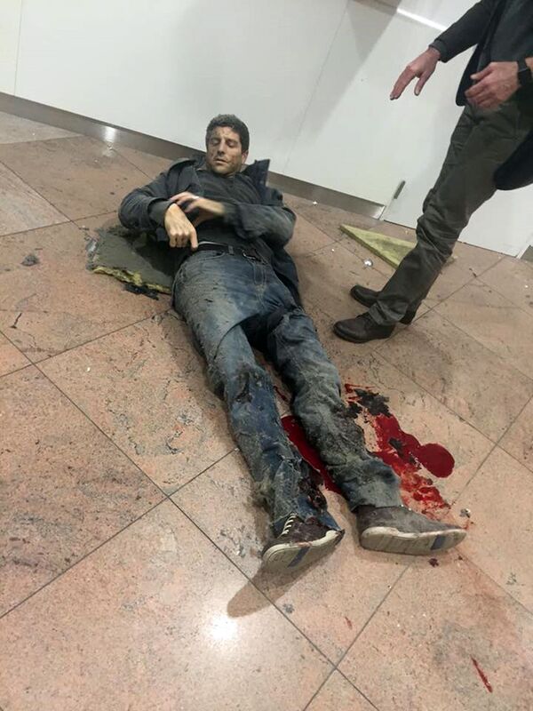 Người bị thương trong vụ nổ tại sân bay Brussels - Sputnik Việt Nam