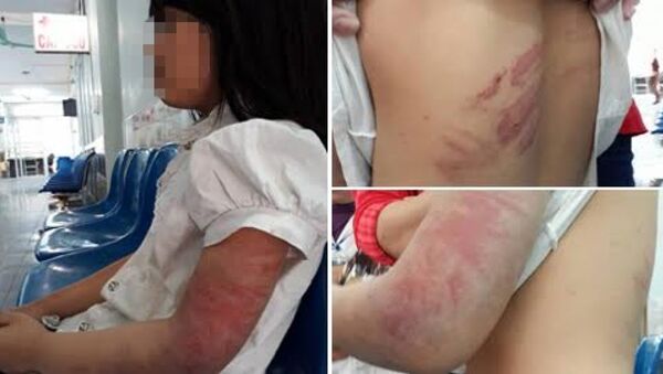 Hình ảnh bé gái bị bố đánh vào ngày 28/3 - Sputnik Việt Nam