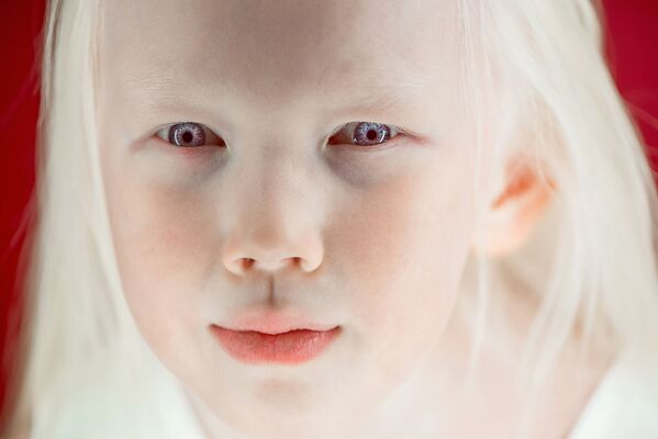 Cô bé bạch tạng Nariyana, Cộng hòa Sakha (Yakutia) - Sputnik Việt Nam