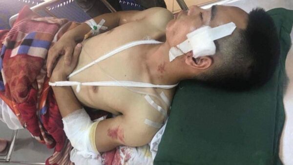 Anh Toàn (anh ruột anh Tâm) đang được điều trị tại Bệnh viện Đa khoa tỉnh Hải Dương. - Sputnik Việt Nam