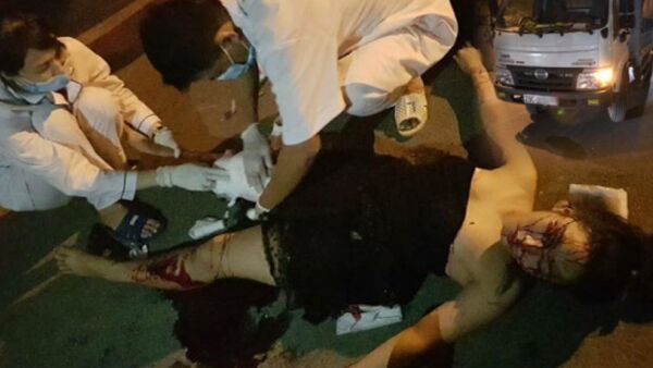 Thiếu nữ chà mặt xuống đường, bị chấn thương nặng ở chân - Sputnik Việt Nam
