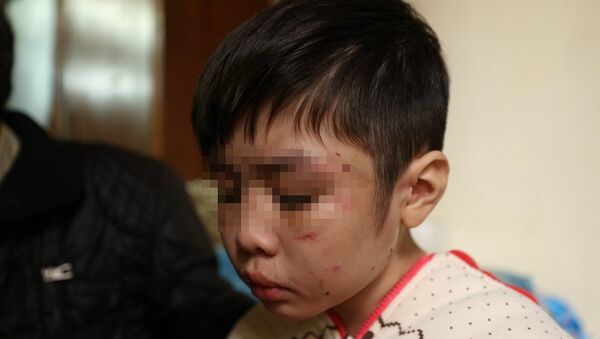 Bé trai 10 tuổi bị bạo hành - Sputnik Việt Nam