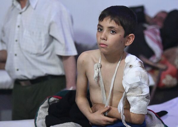 Bệnh nhân của bệnh viện ngầm thành phố Douma ở ngoại ô Damascus - Sputnik Việt Nam