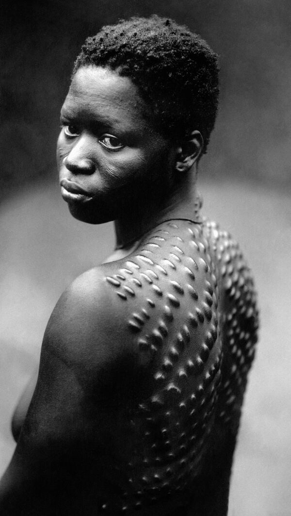 Các bộ lạc châu Phi thấy biểu hiện của sắc đẹp là những cô gái có làn da đầy sẹo. - Sputnik Việt Nam
