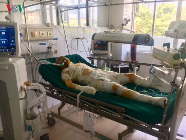 Người đàn ông tẩm xăng đốt 5 người một nhà: Sức khỏe các nạn nhân giờ ra sao? Người đàn ông tẩm xăng đốt 5 người một nhà: Sức khỏe các nạn nhân giờ ra sao? - Sputnik Việt Nam