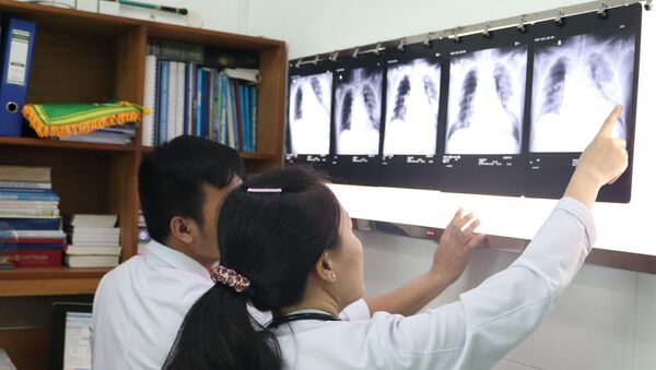Các bác sỹ Bệnh viện Chợ Rẫy Thành phố Hồ Chí Minh kiểm tra tình trạng phổi của bệnh nhân Li Ding ngày 30/1 - Sputnik Việt Nam