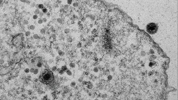 Yaravirus brasiliensis trong tế bào amip - Sputnik Việt Nam