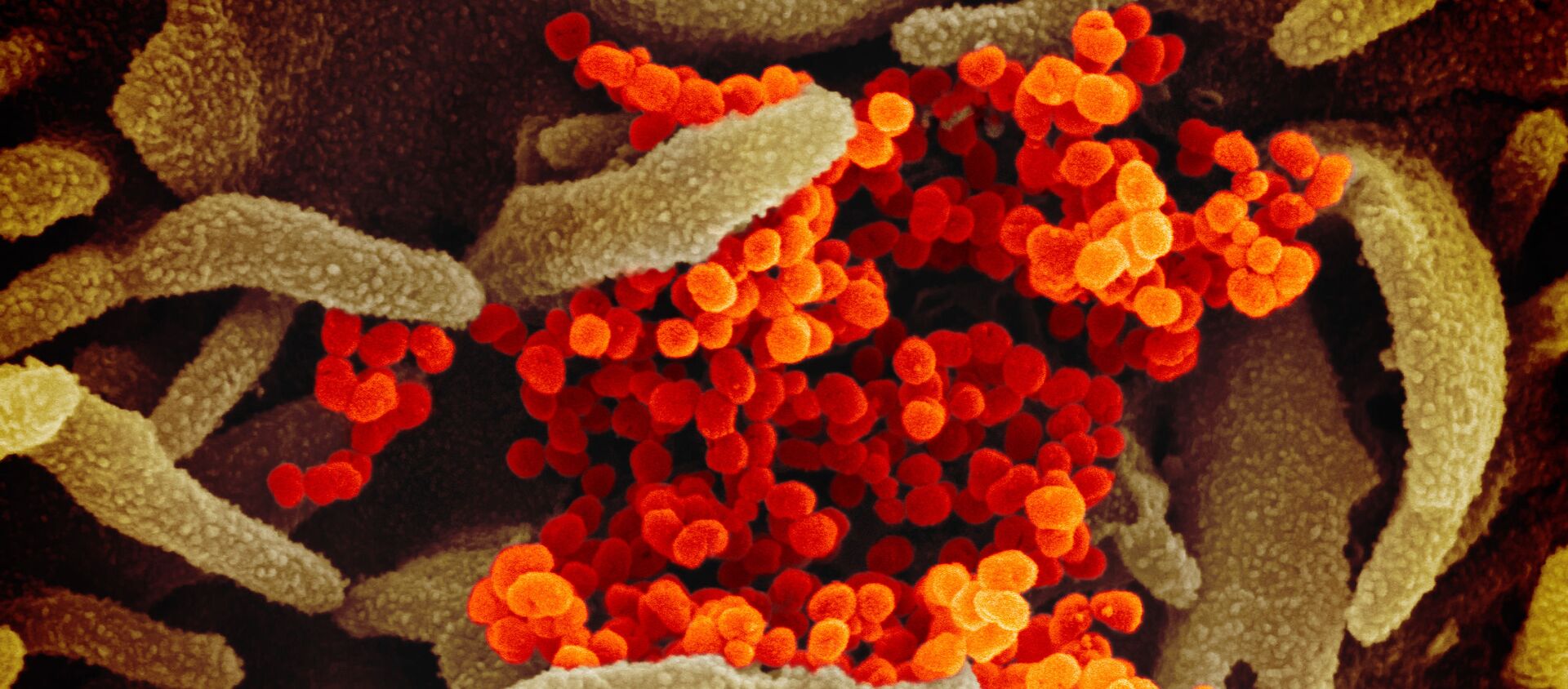 Hình ảnh màu của coronavirus SARS-CoV-2 mới - Sputnik Việt Nam, 1920, 31.05.2021