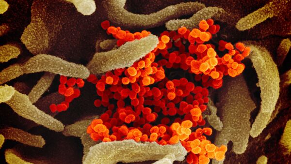 Hình ảnh màu của coronavirus SARS-CoV-2 mới - Sputnik Việt Nam