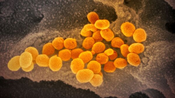 Hình ảnh màu của coronavirus SARS-CoV-2 mới - Sputnik Việt Nam