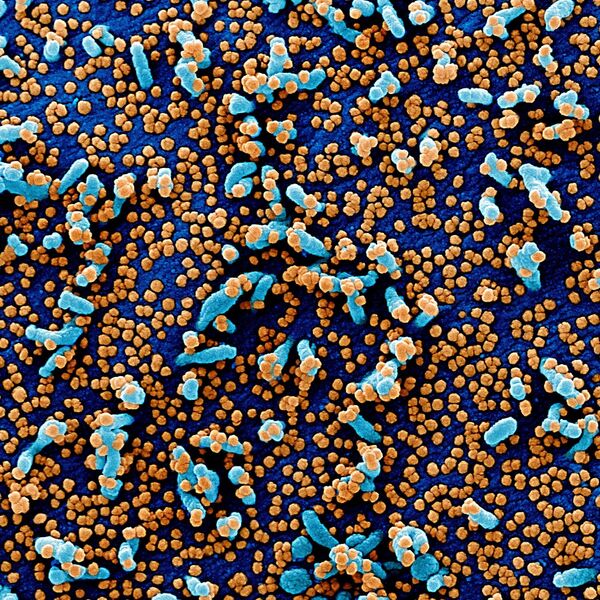 Tế bào nhiễm coronavirus soi dưới kính hiển vi - Sputnik Việt Nam