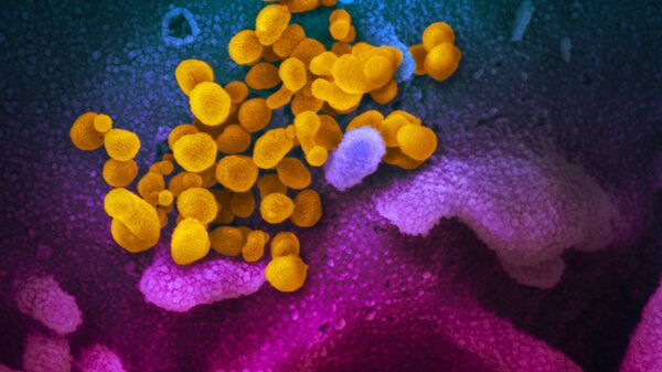 Ảnh màu của chủng coronavirus mới SARS-CoV-2 - Sputnik Việt Nam
