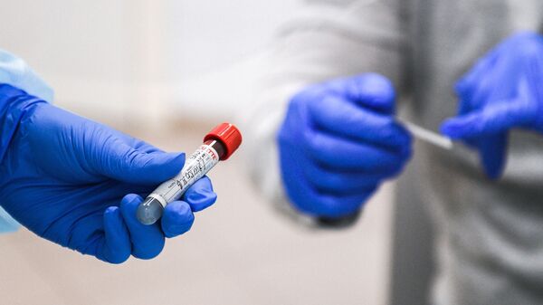 Ống nghiệm có máu xét nghiệm sự hiện diện của kháng thể với virus SARS-CoV-2. - Sputnik Việt Nam